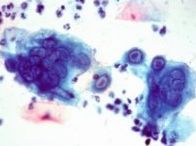 染色されたウイルス感染細胞