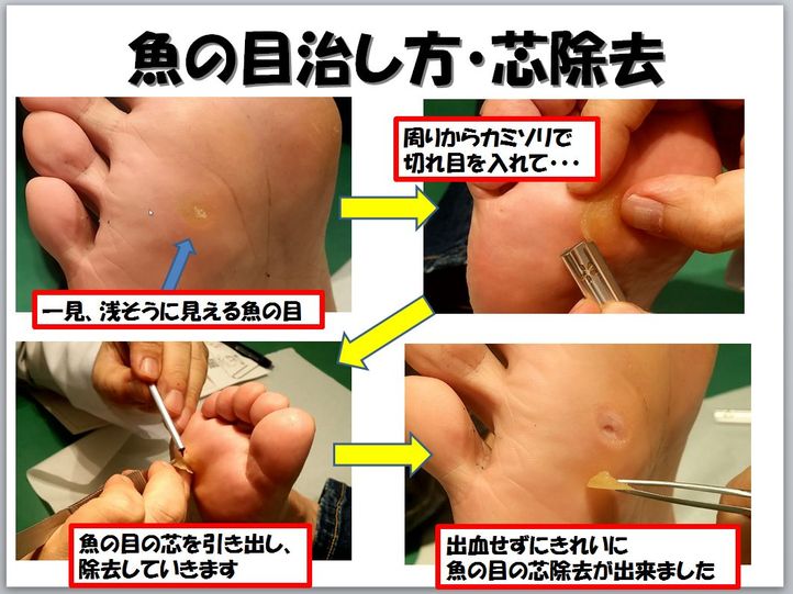 手の乾燥の原因は何ですか?